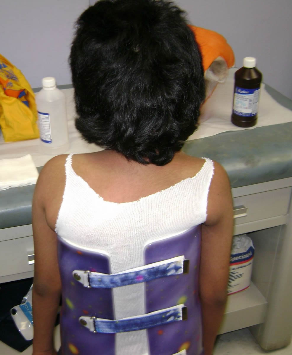 Felito back view